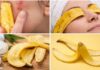 ਲਾਈਫਸਟਾਇਲ: ਕੇਲੇ ਦਾ ਛਿਲਕਾ – ਸੁੰਦਰਤਾ ਅਤੇ ਸਿਹਤ ਦਾ ਅਨਮੋਲ ਖਜ਼ਾਨਾ